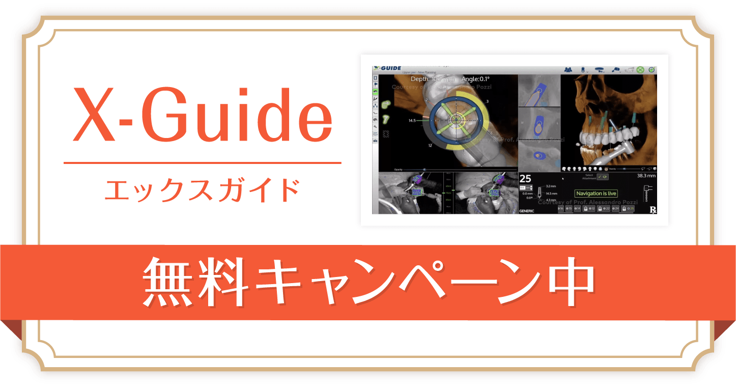 X-Guide無料キャンペーン中